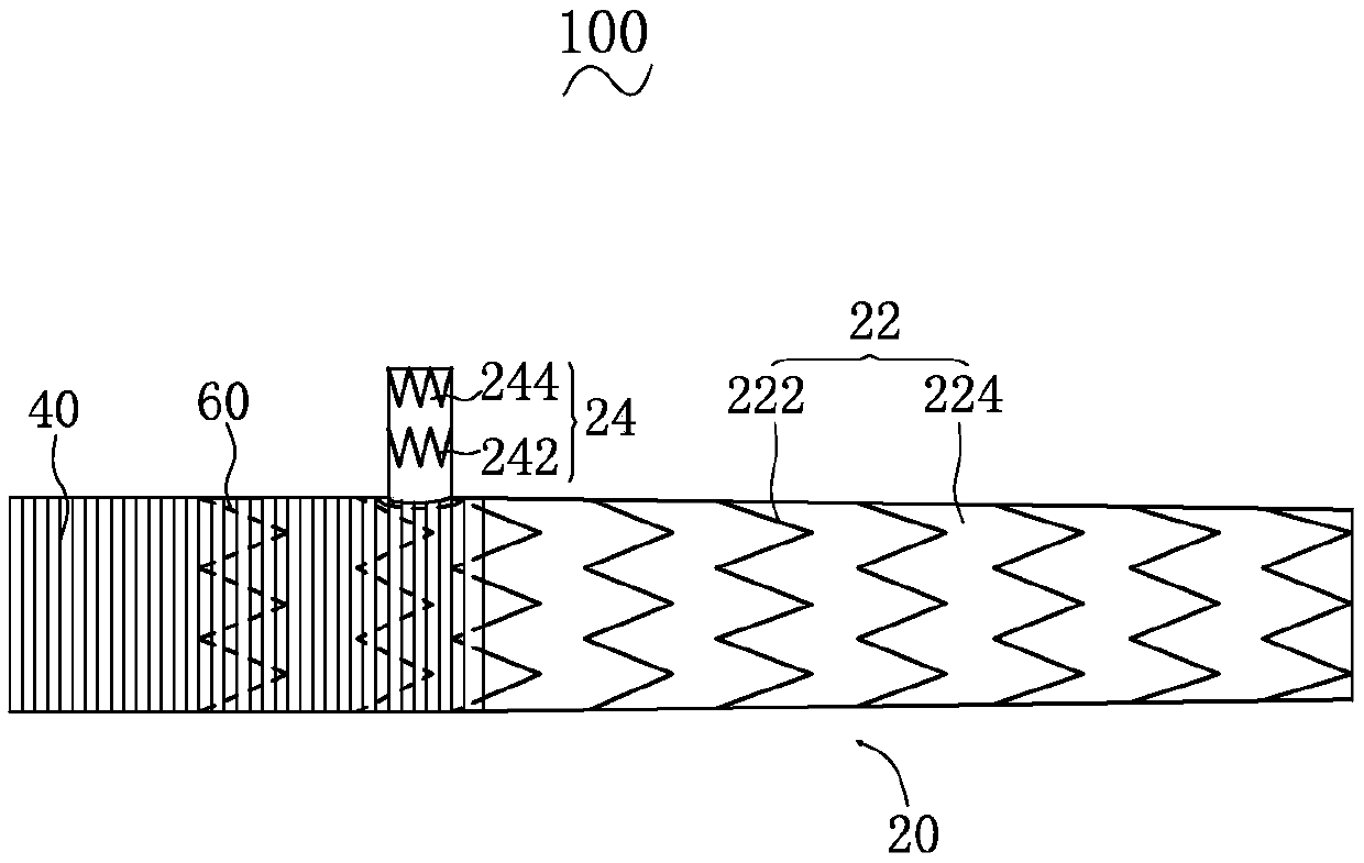 Intraoperative stent