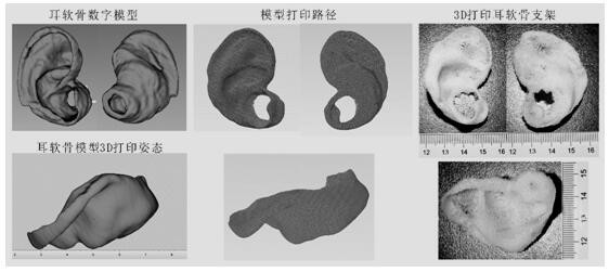 A 3D-printed mechanical bionic auricular cartilage tissue engineering scaffold and its manufacturing method