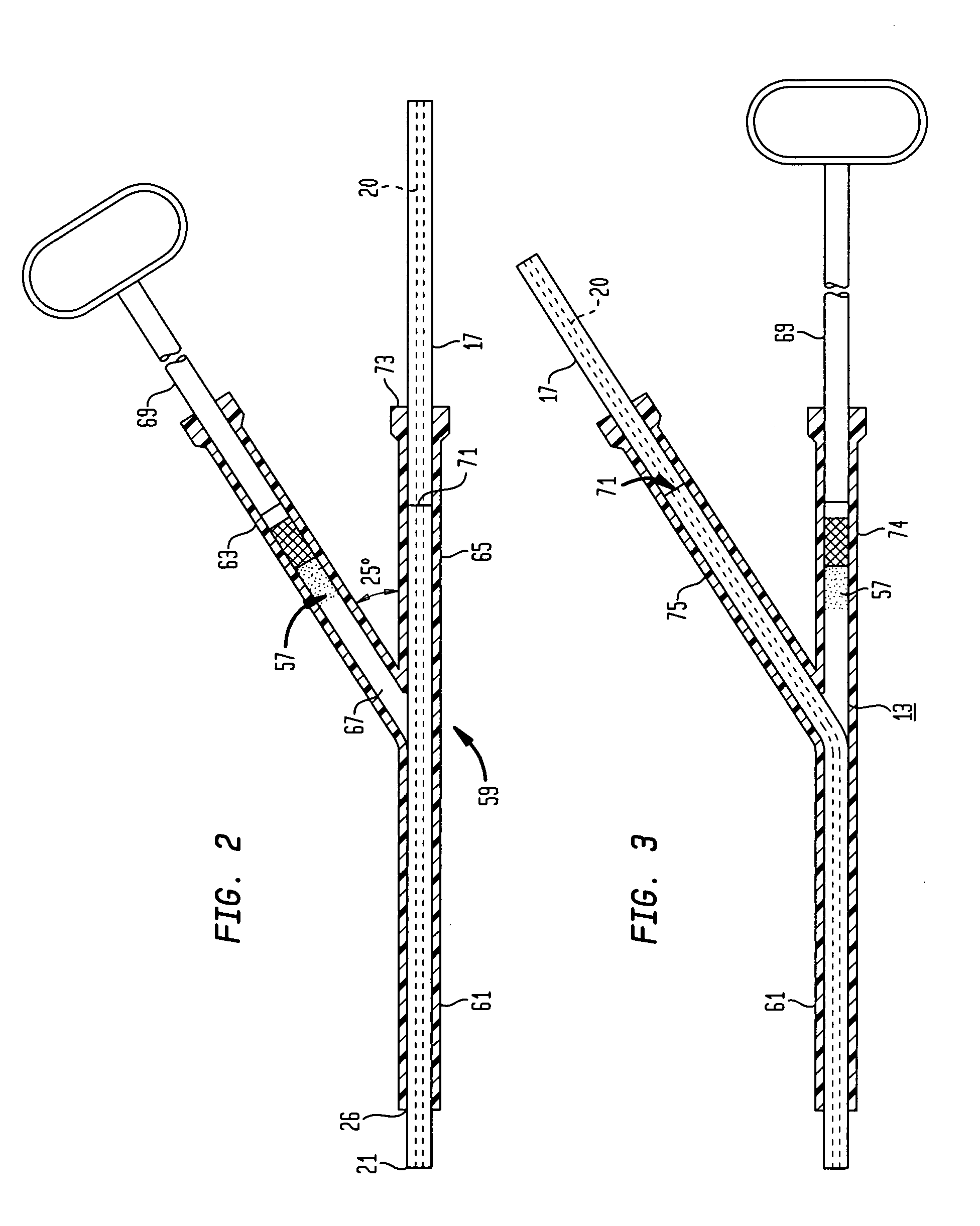 Device and method for sealing puncture wounds