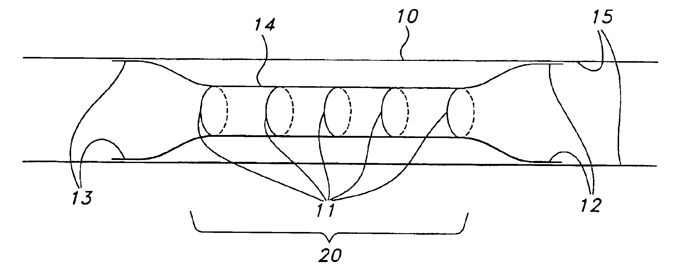 Stent with controlled expansion