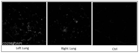 A method for culturing lung and lung cancer tissue and a method for constructing a mouse animal model of lung cancer using the same