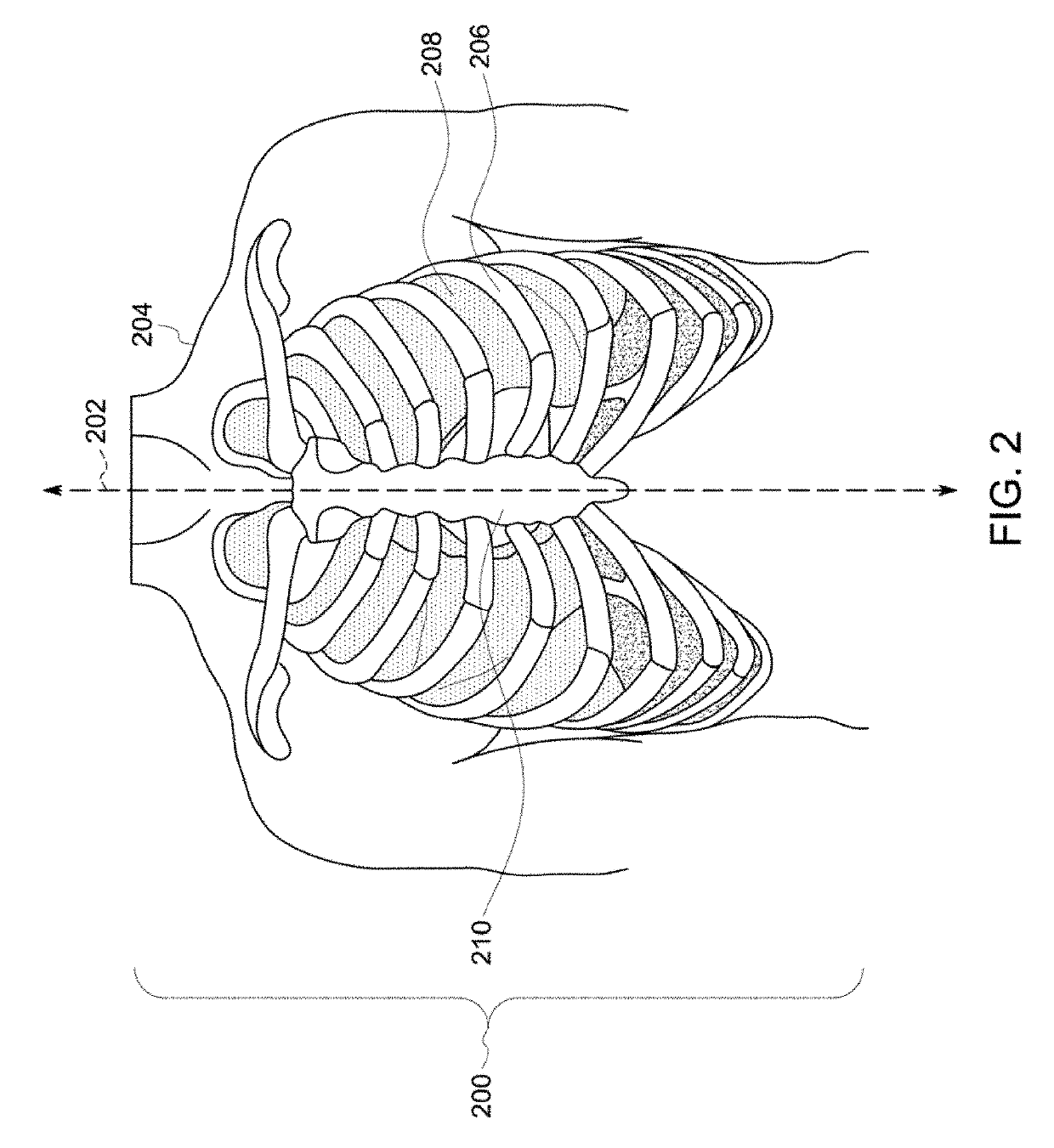 Ultrasound imaging system and method