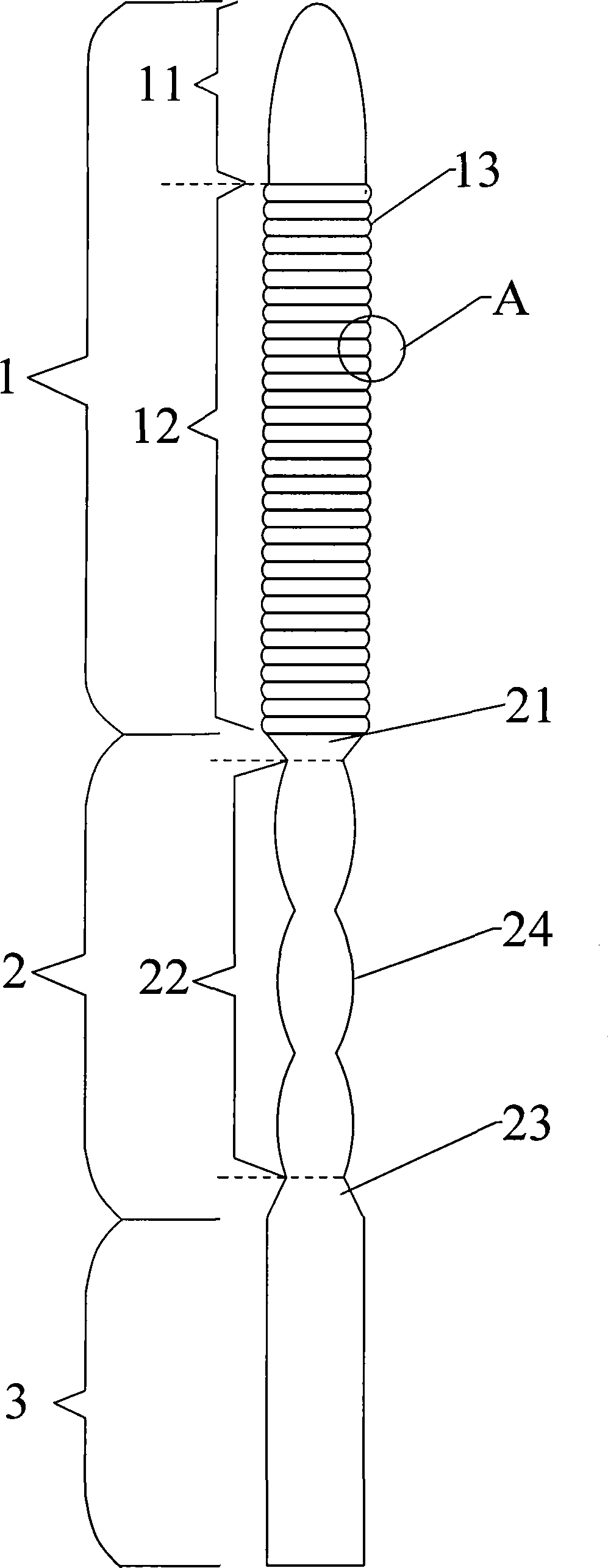 Shape memory contraceptive device on oviduct for realizing contraception