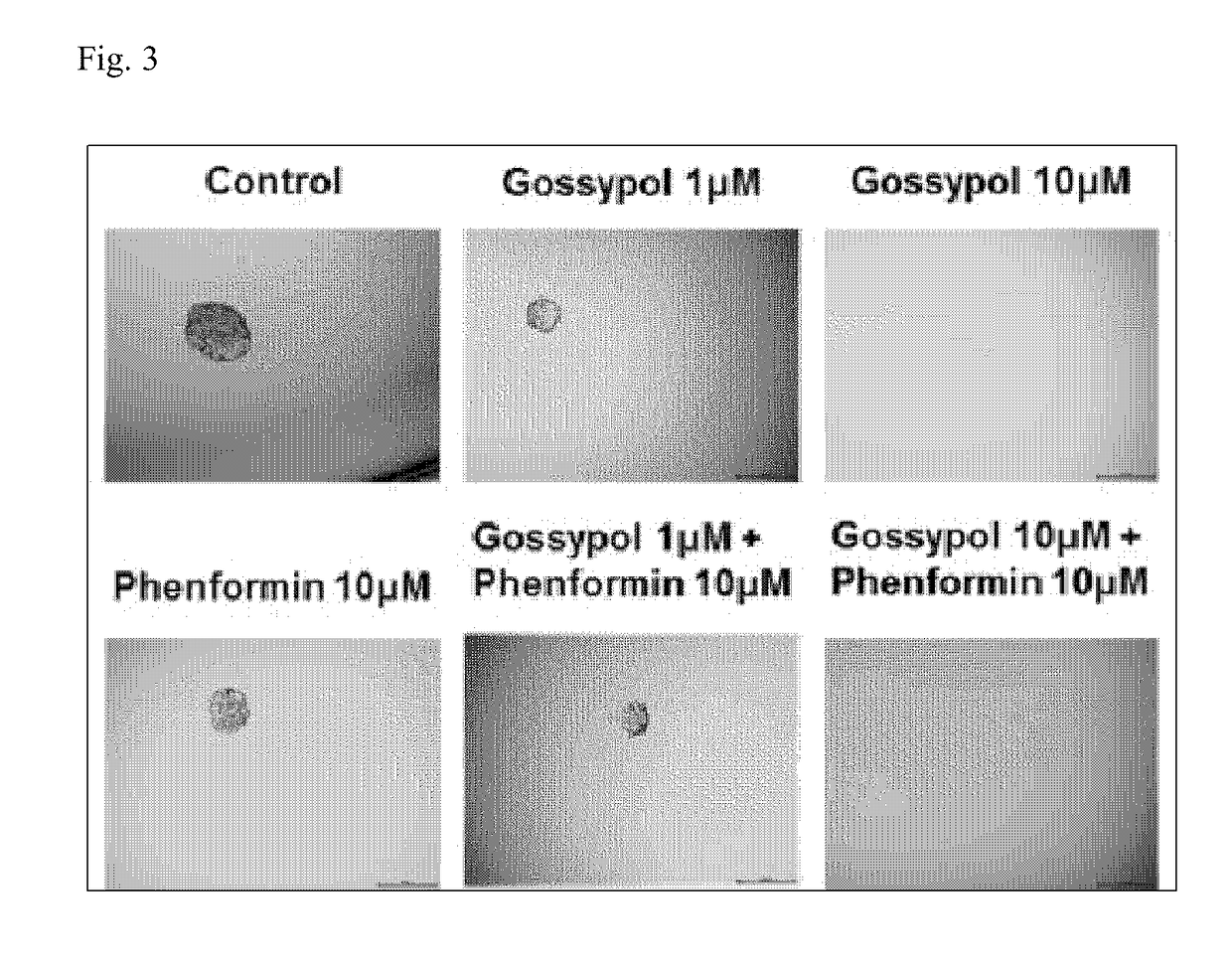 Pharmaceutical composition for inhibiting growth of cancer stem cells, containing aldehyde inhibitor and biguanide-based compound