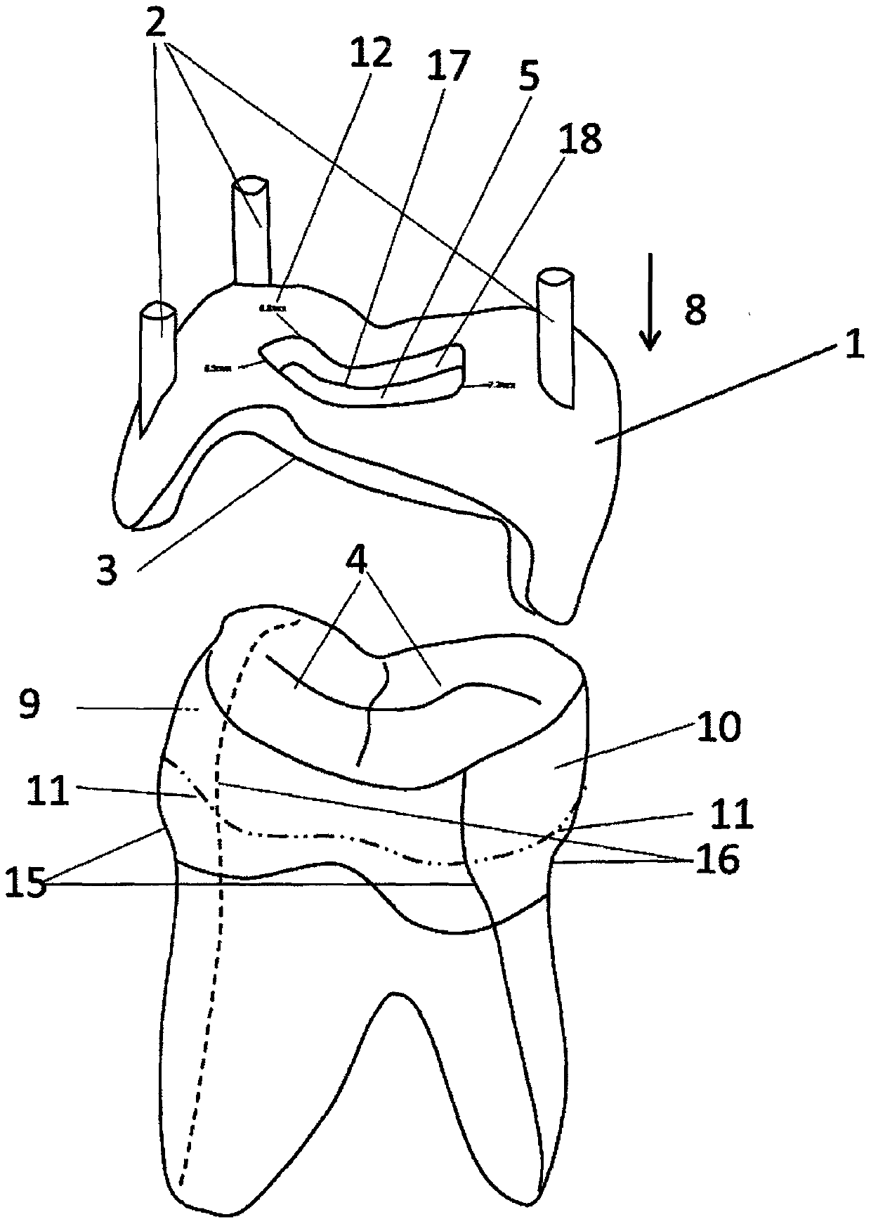 Guide device for dental pulp cavity preparation and method for making the device