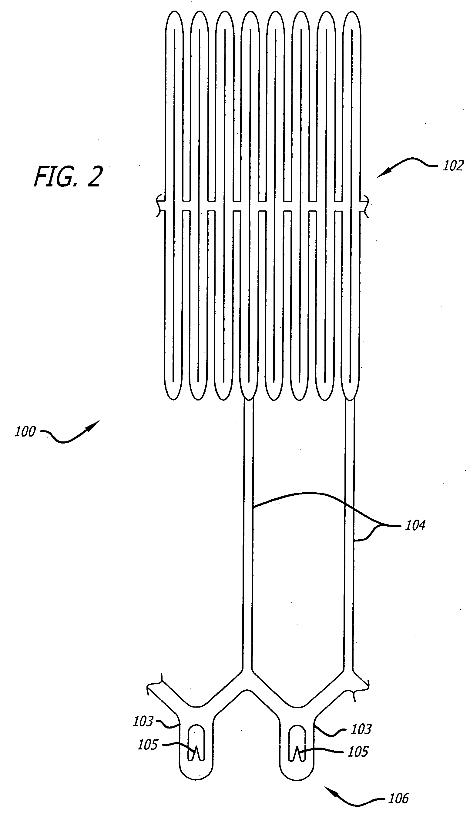 Electrical conduction block implant device