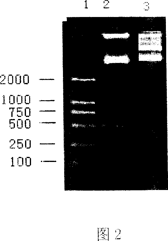 Application process of pig interleukin 2 and 6 gene expression plasmid anti-infectious preparation