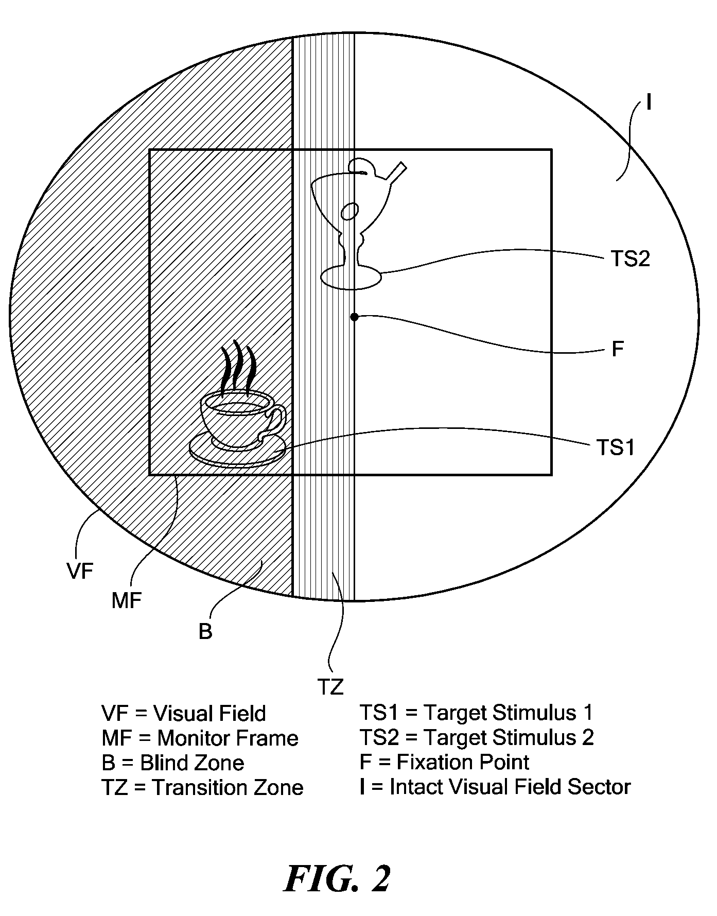 Process and device for treating blind regions of the visual field