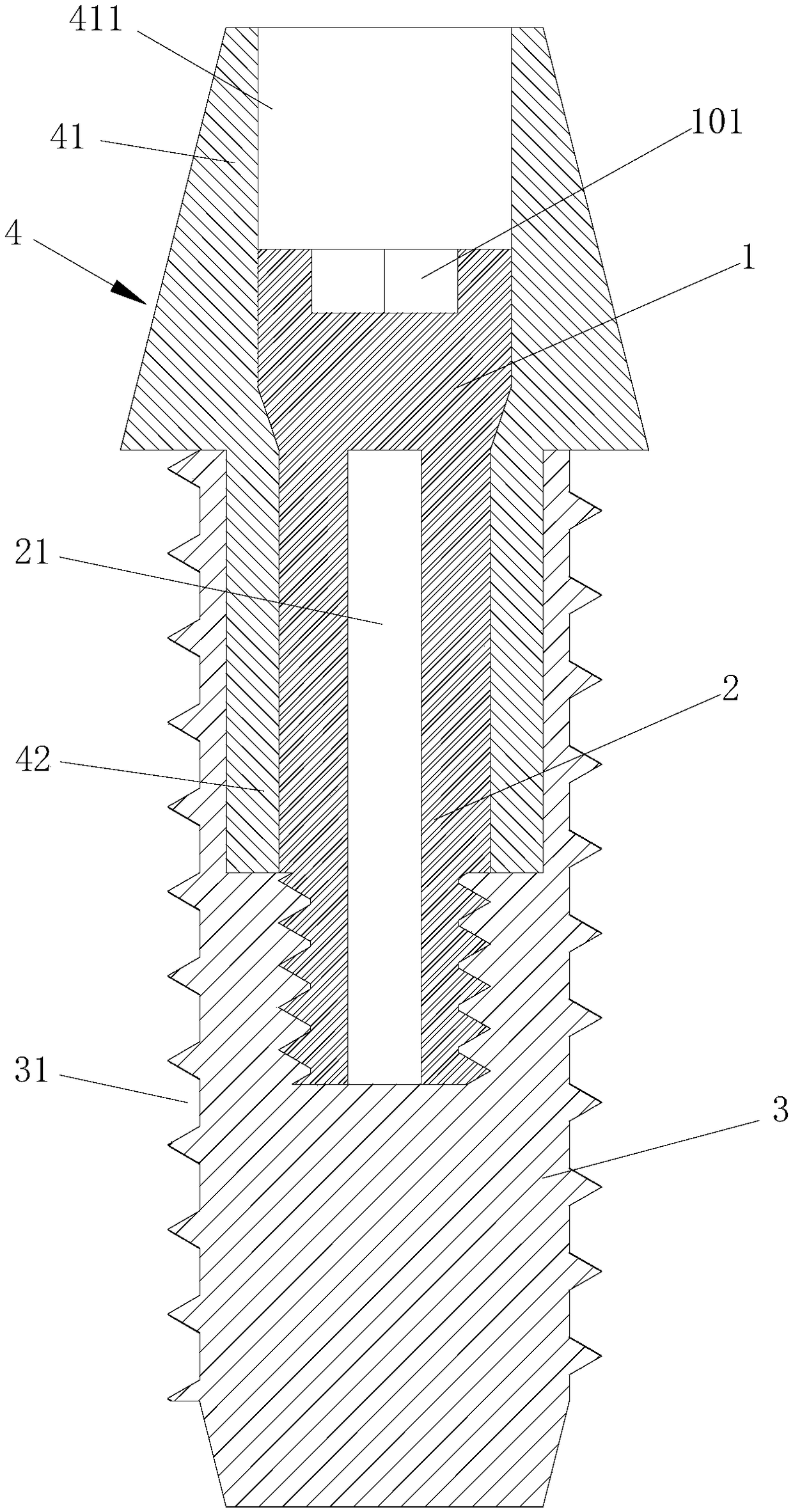 Central screw of dental implant and fracture repairing device thereof