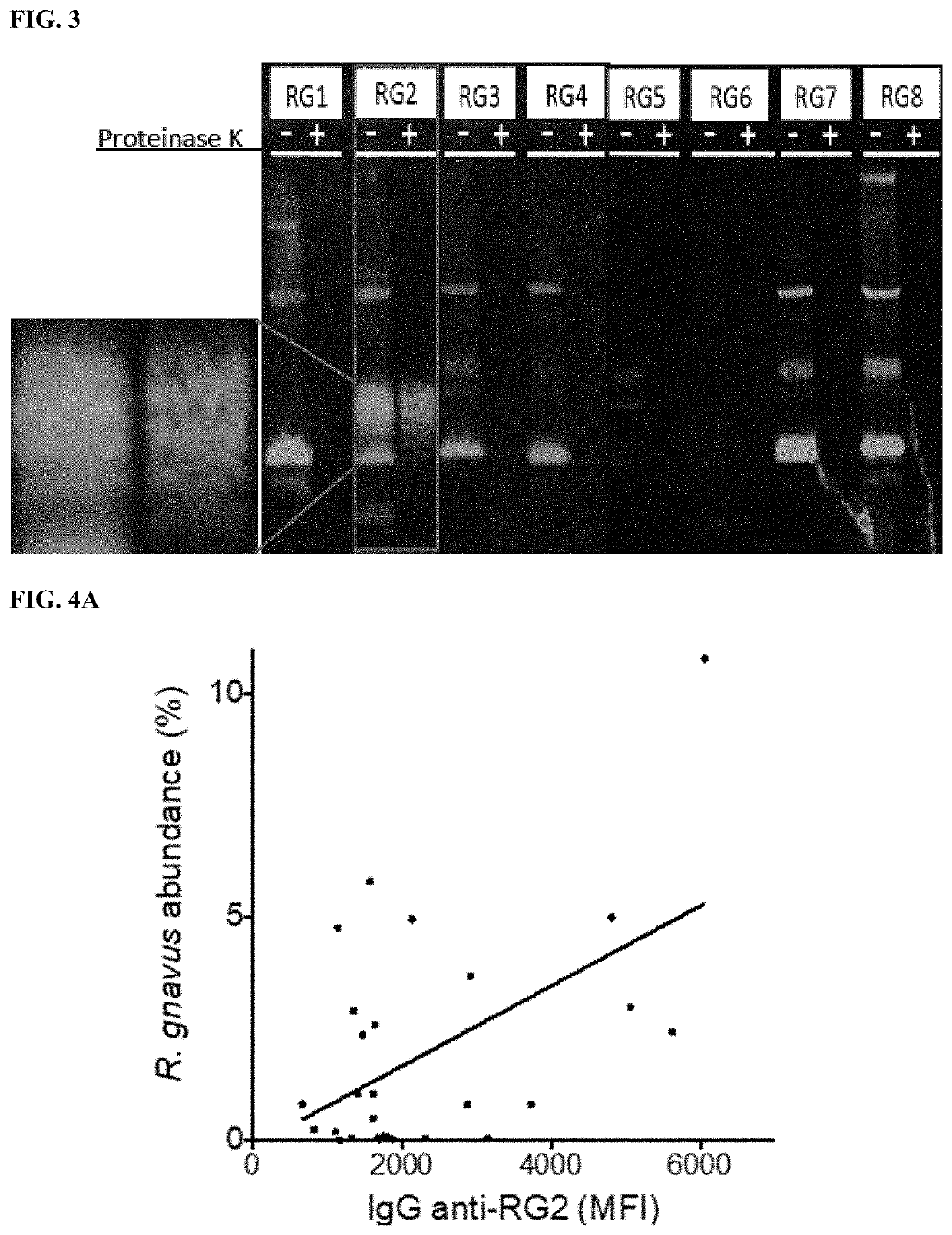 Methods and compositions for treating and diagnosing autoimmune diseases