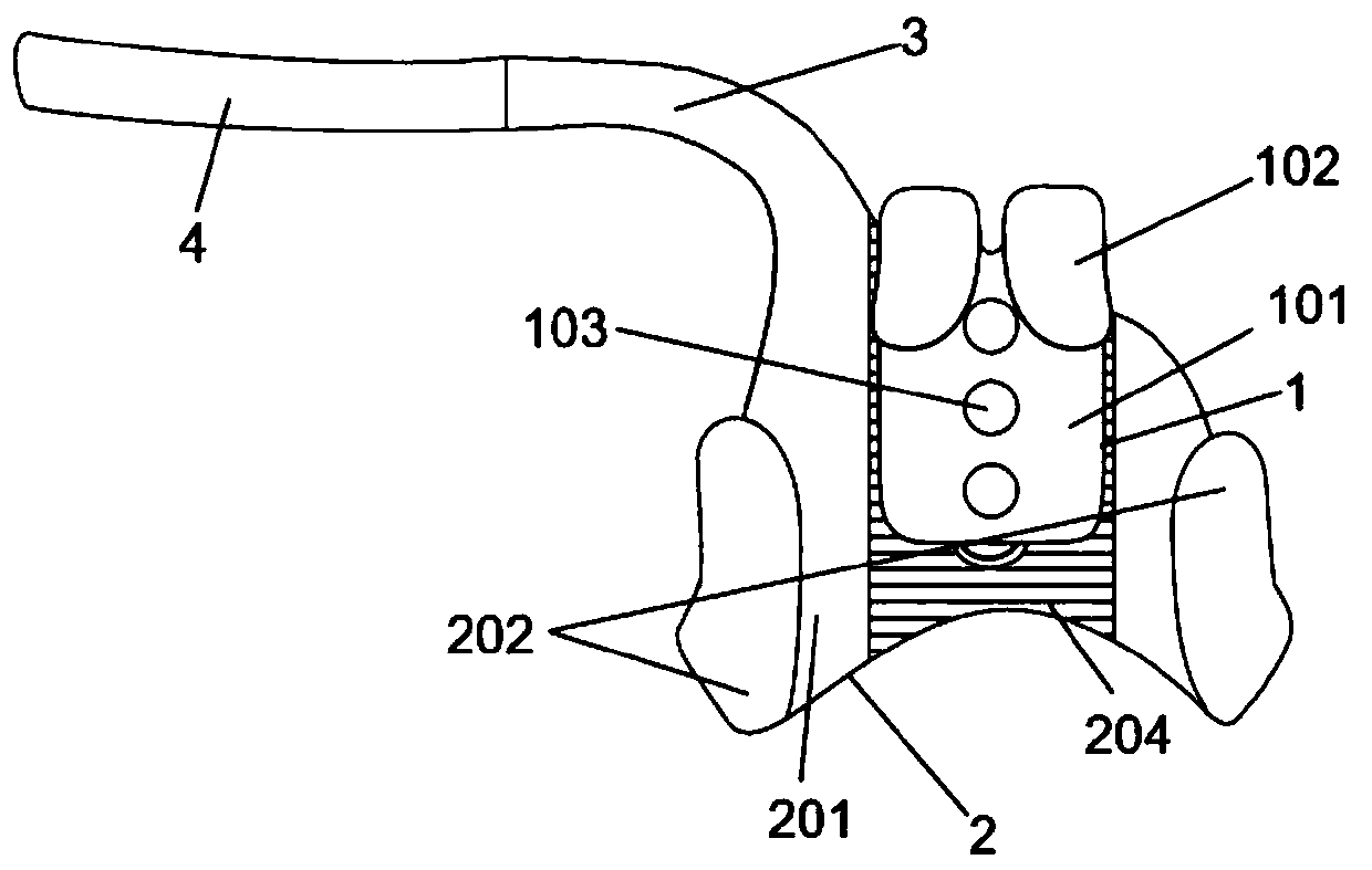 Sternoclavicular joint elastic inner fixing device