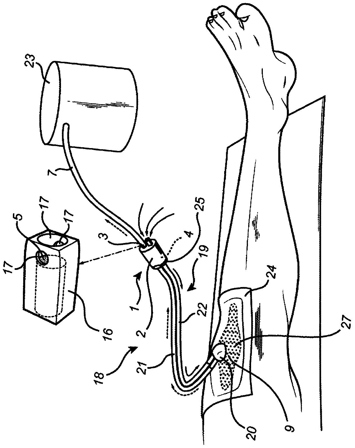 Connector device for a negative pressure wound therapy system