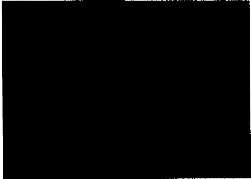 Anti-bladder cancer target superantigen and preparation method thereof