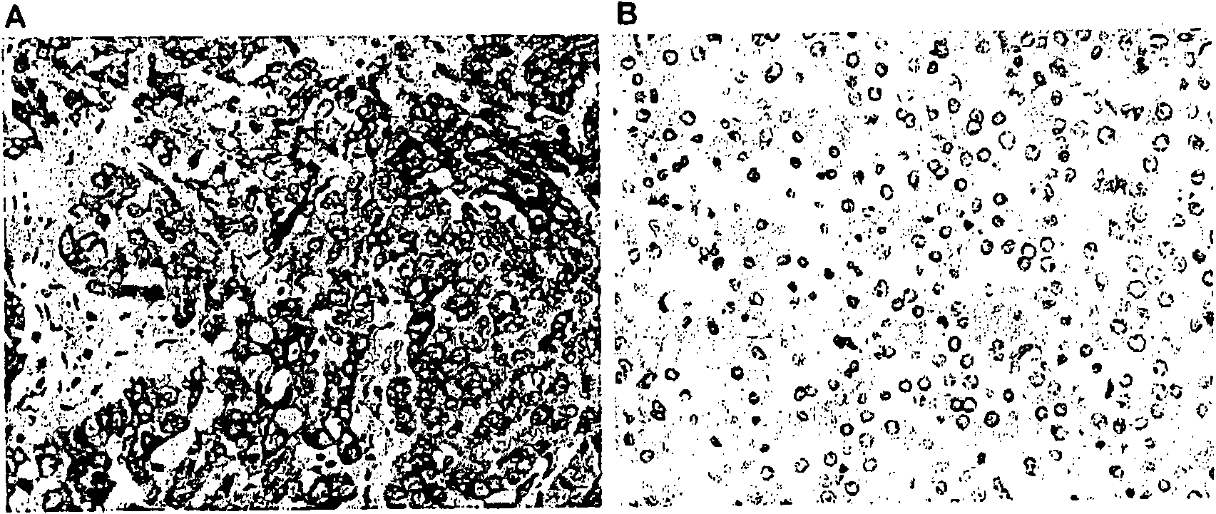 The use of granulin-epithelin precursor (GEP) antibodies for detection and suppression of hepatocellular carcinoma (HCC)