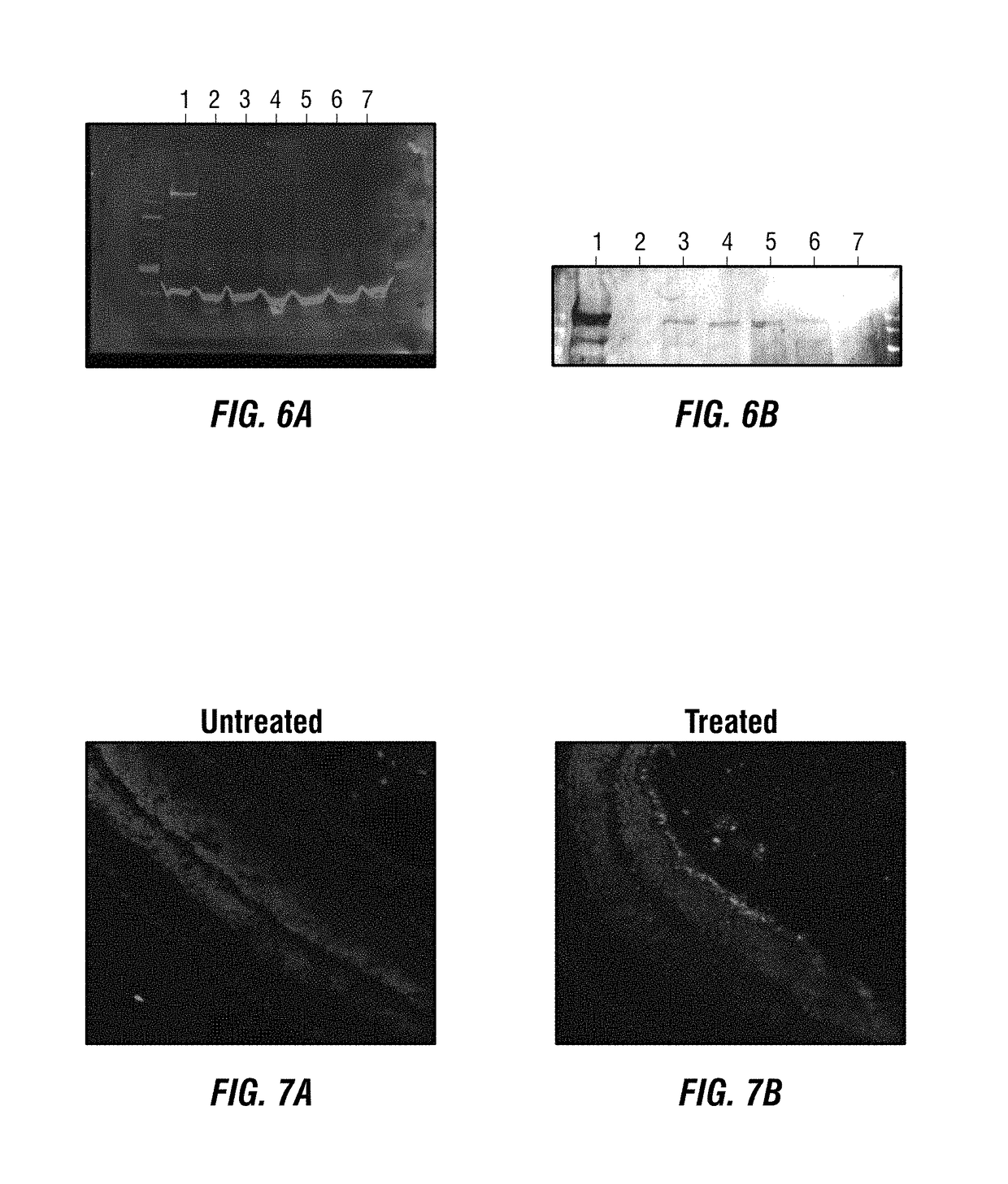 Dual-AAV vector-based systems and methods for delivering oversized genes to mammalian cells