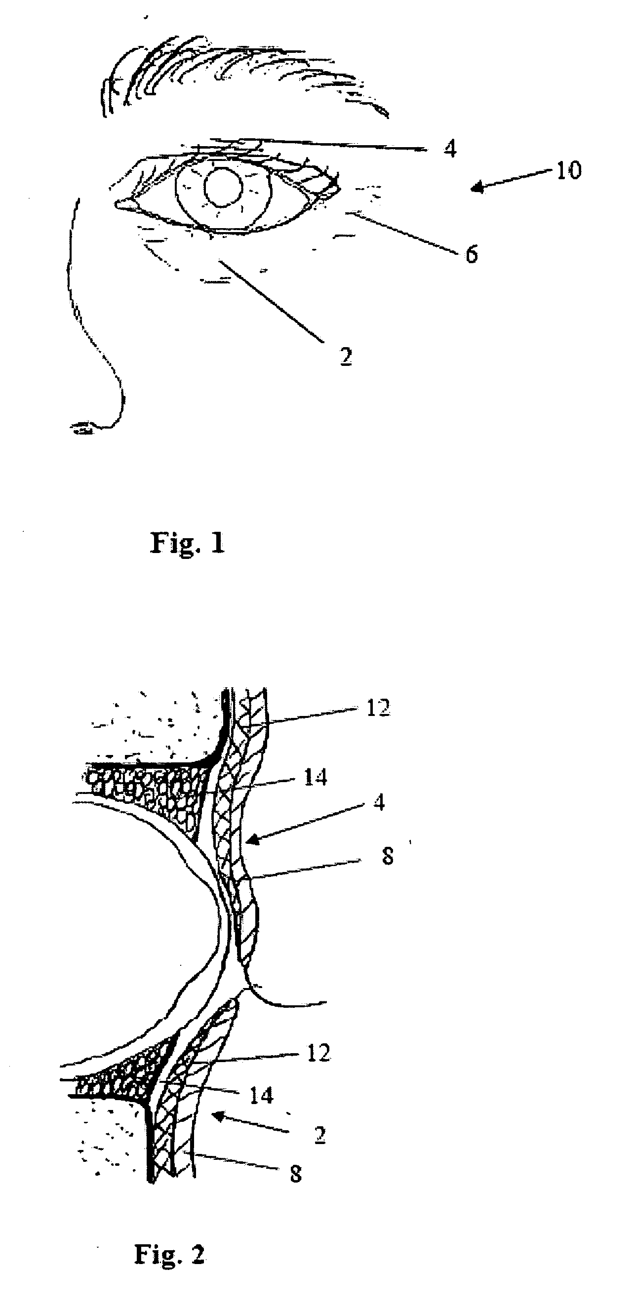Device and methods for treatment of tissue