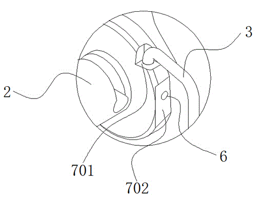 Ultrasonic negative-pressure in-vivo stone removing device