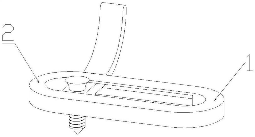 Spine internal fixing device and preparation method thereof