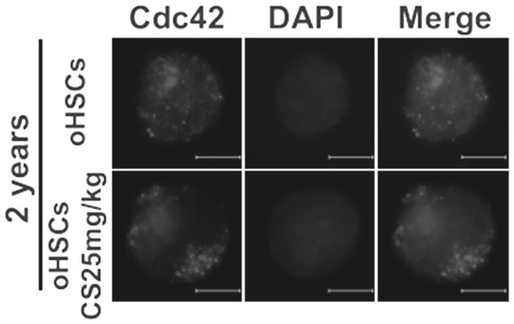 Application of RORa protein and agonist thereof in preparation of anti-aging drugs