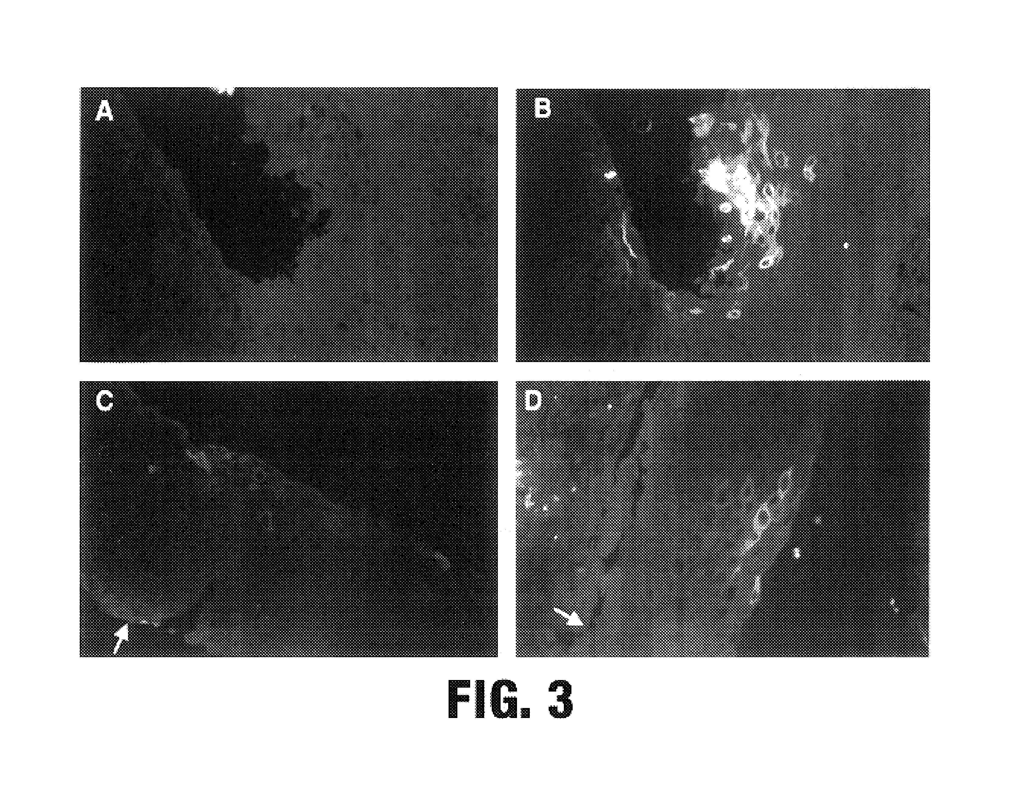 Screening for papilloma viruses