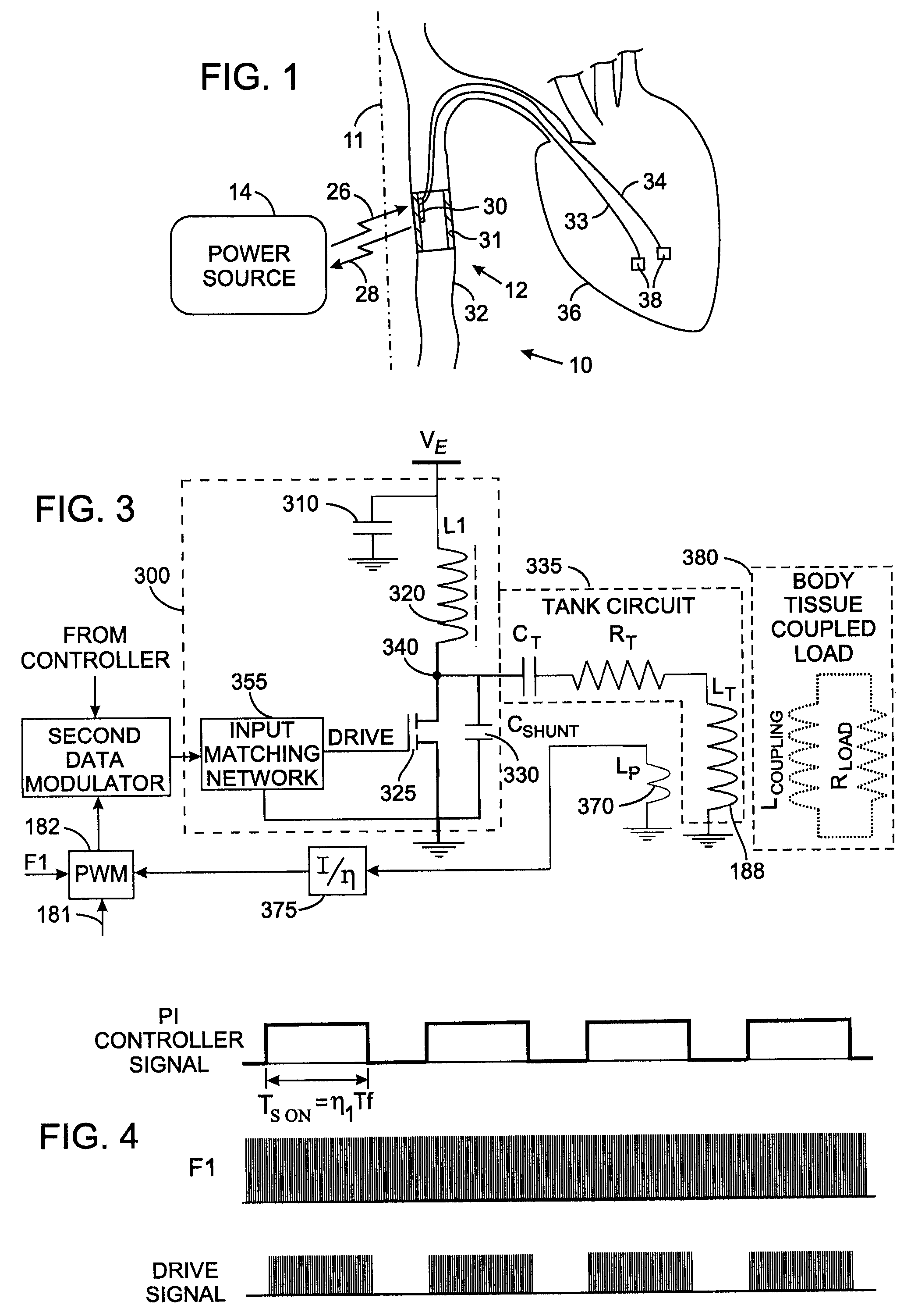 Class-e radio frequency amplifier for use with an implantable medical device