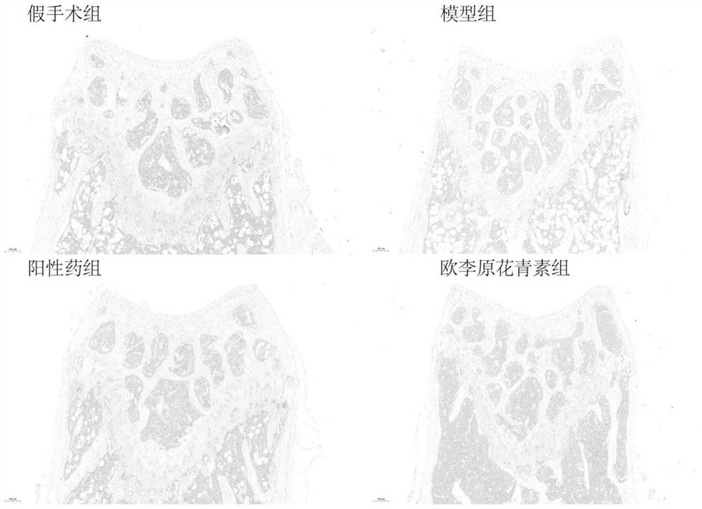 Prunus humilis procyanidine as well as preparation method, application and medicine thereof