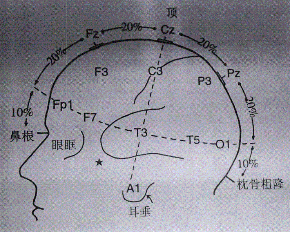 Electrode placement position determining device and method for scalp electroencephalogram