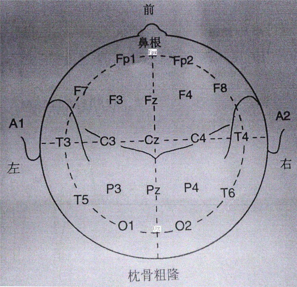 Electrode placement position determining device and method for scalp electroencephalogram