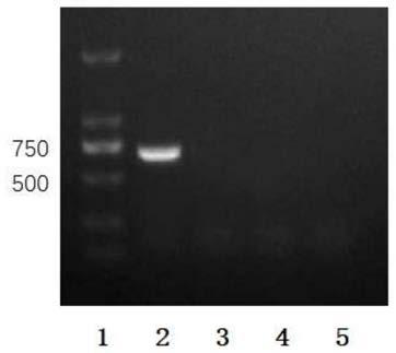 Rough type brucella of recombinant fine-granule echinococcus Eg95 gene and vaccine production method thereof