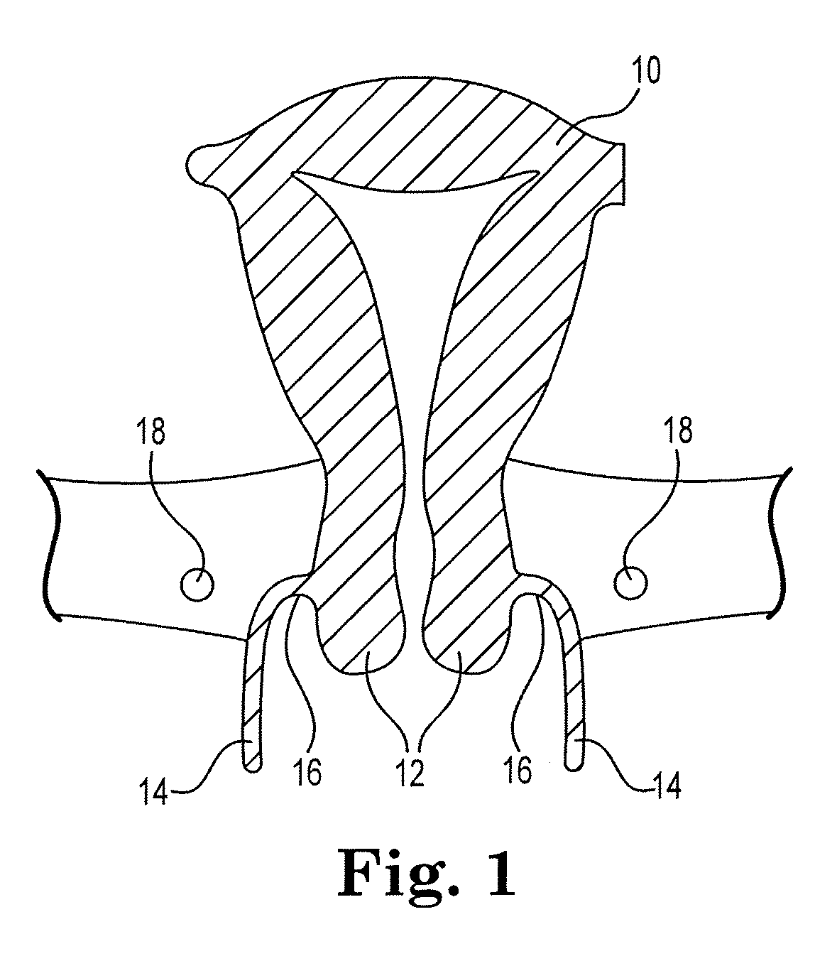 Device and method for illumination of vaginal fornix with ureter location, isolation and protection during hysterectomy procedure