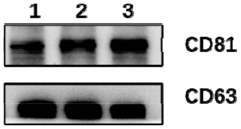 Application of stem cell-derived exosome in preparation of medicine for treating chronic obstructive pulmonary disease