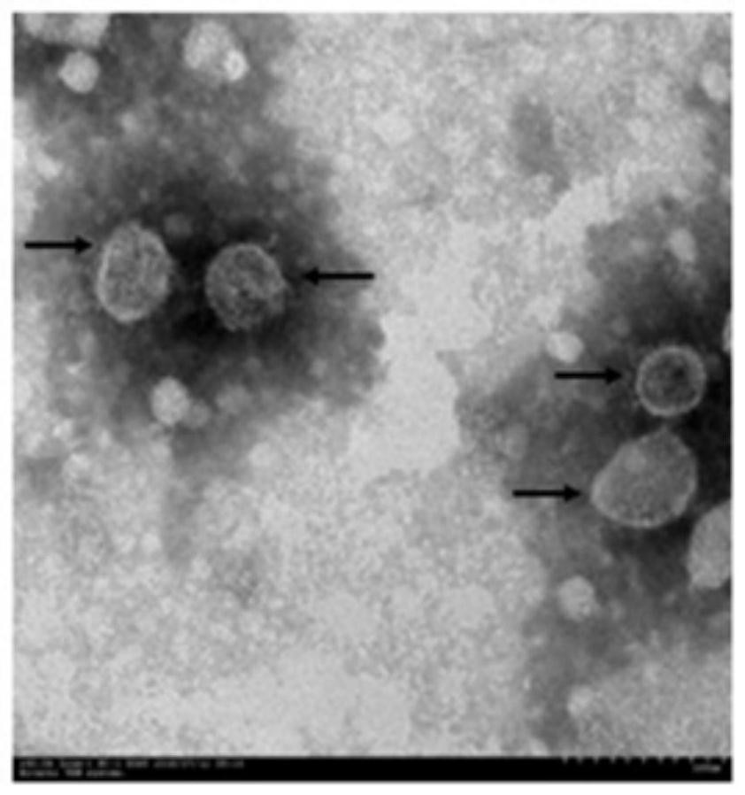 Application of stem cell-derived exosome in preparation of medicine for treating chronic obstructive pulmonary disease