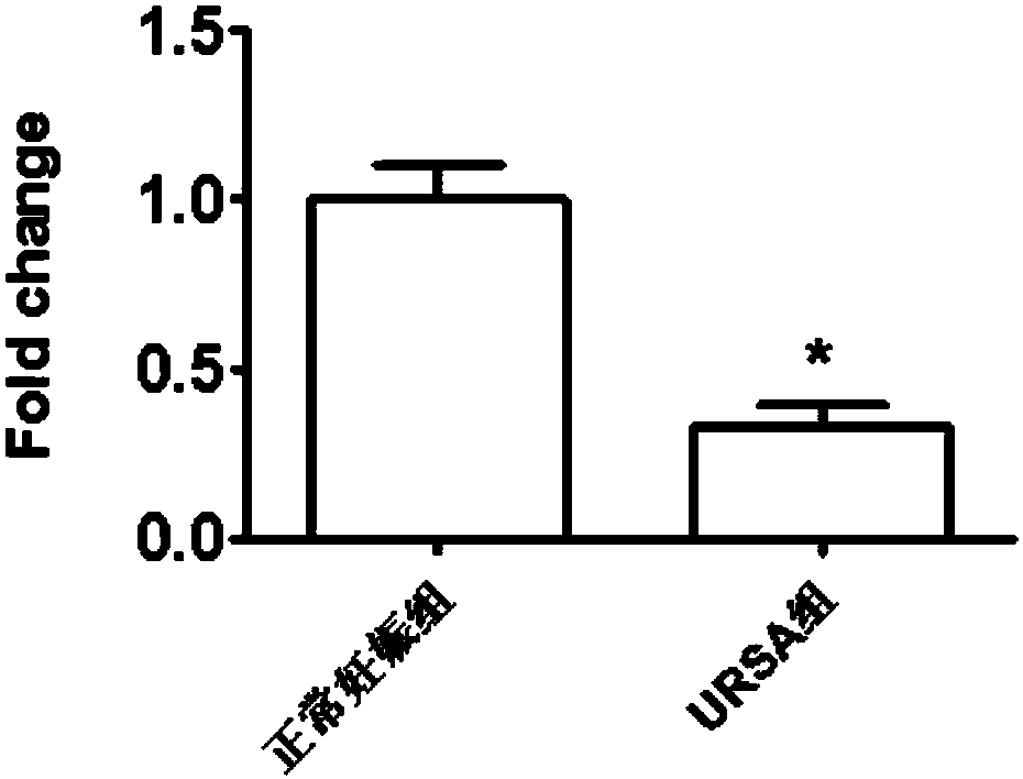 Application of circ-0079591 in serum as marker for URSA diagnosis and pregnancy outcome assessment
