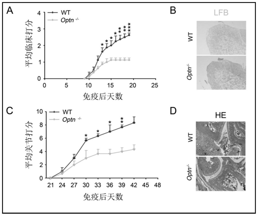 Application of targeting optineurin in the preparation of drugs for the prevention and treatment of autoimmune diseases