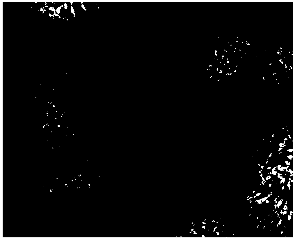 Nickel-based material with spherical core-nano porous shell composite structure and preparation method of nickel-based material