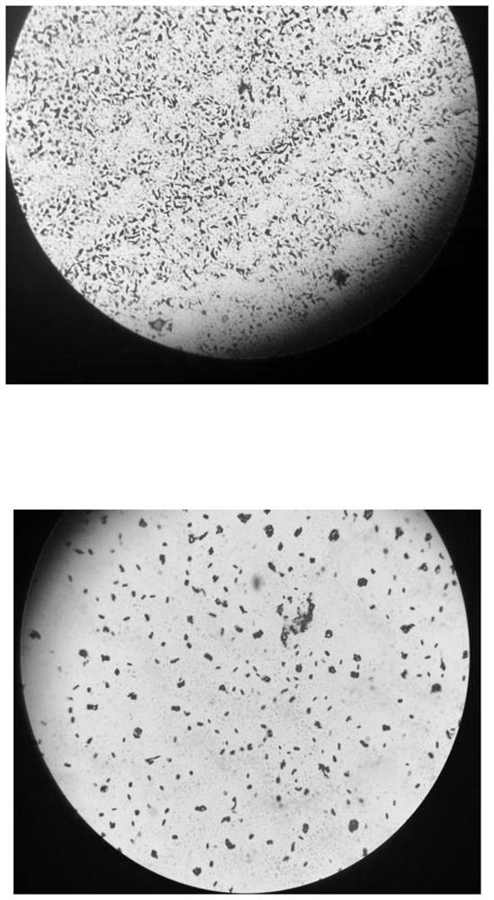 A strain of Bacillus licheniformis with high protease production and its fermentative enzyme production method