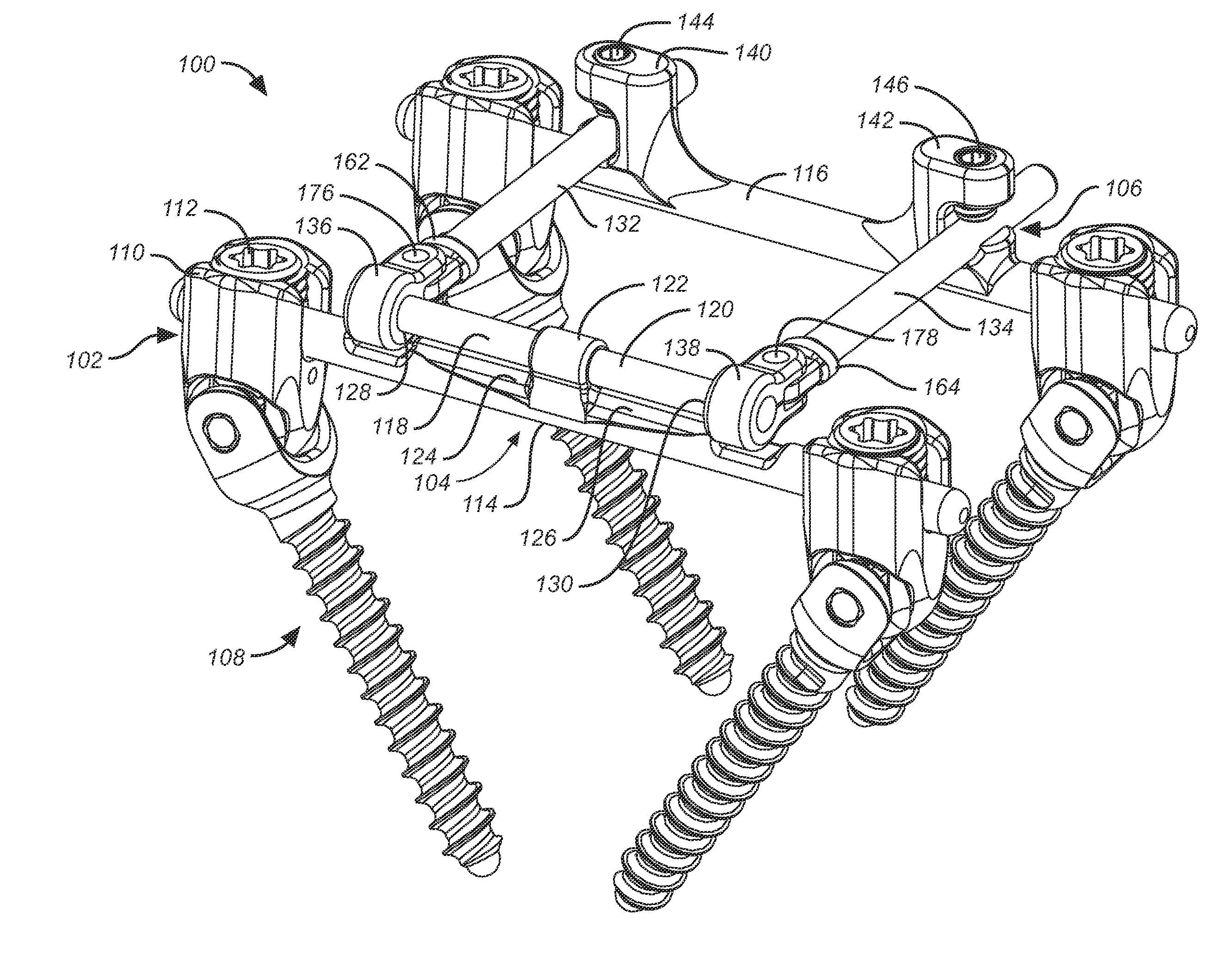 Deflection rod system for a spine implant including an inner rod and an outer shell and method