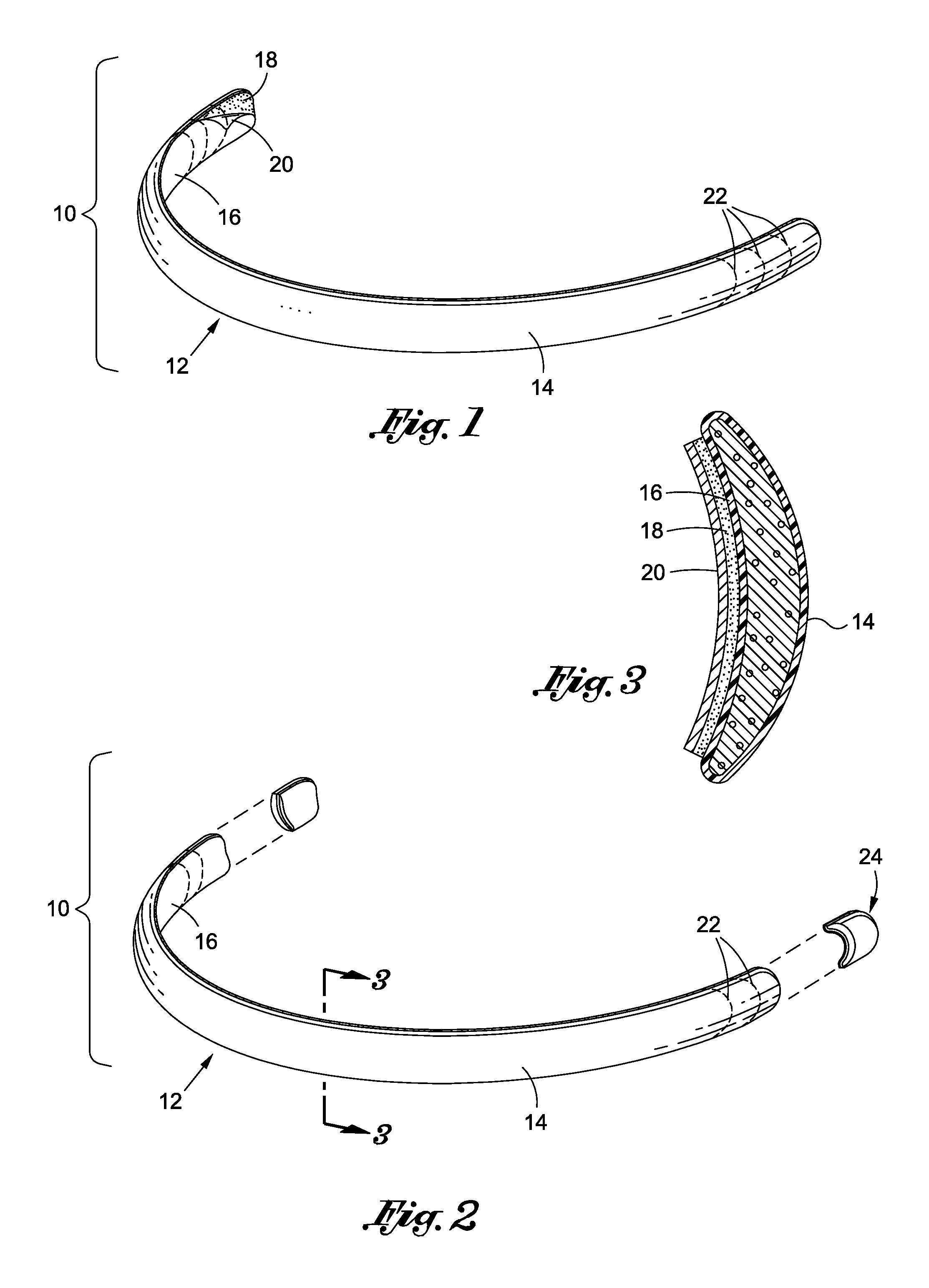 Temporary periodontal prosthetic device that gives the appearance of fuller lips