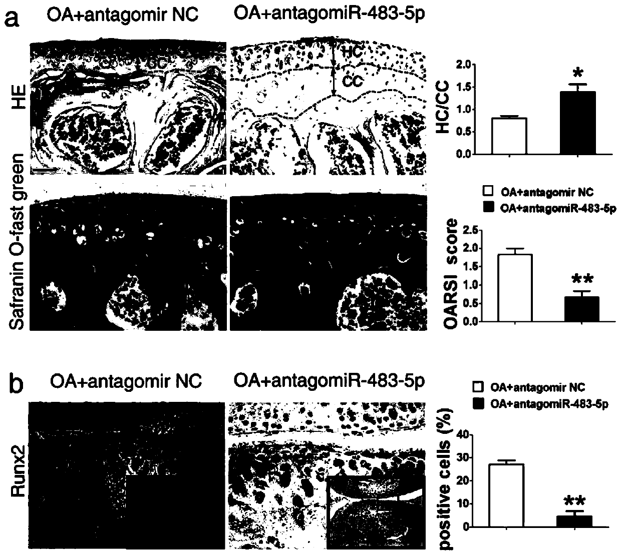 A miRNA-483-5p inhibitor drug and its application in medicine for treating osteoarthritis