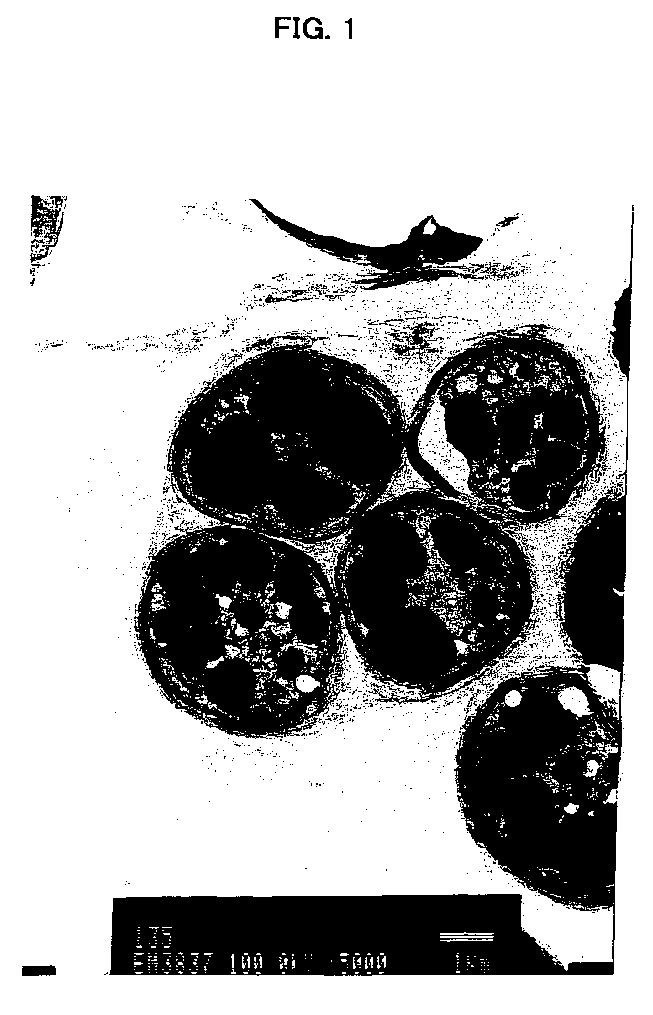 Microorganism and production of carotinoid compounds thereby