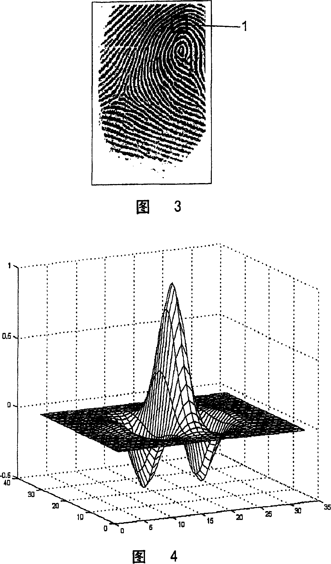Method of filtering an image with bar-shaped structures