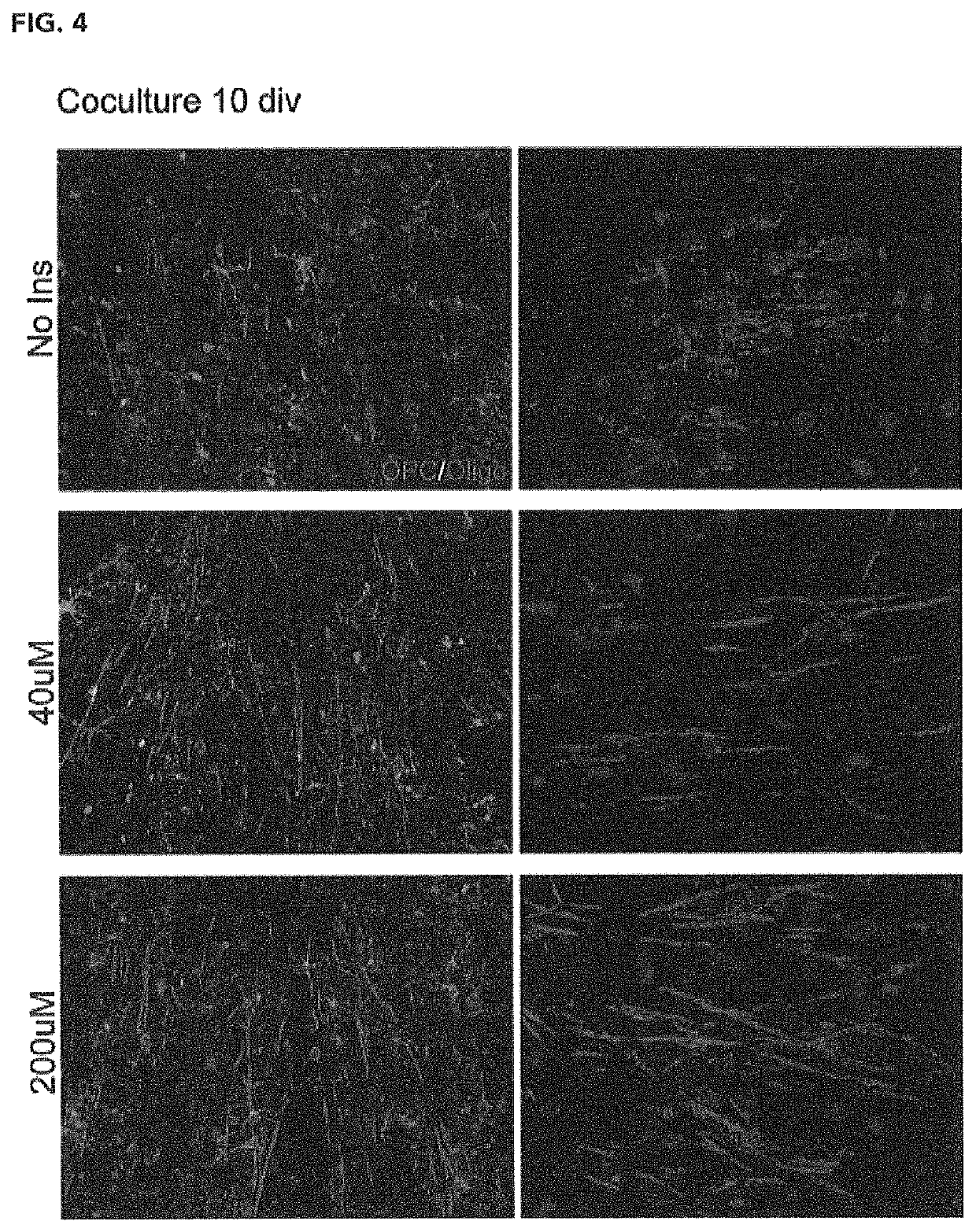 Nutritional compositions containing an elevated level of inositol and uses thereof