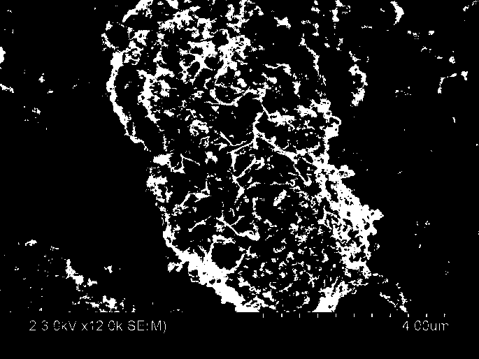 A kind of mesoporous titanium apatite and its preparation method and application