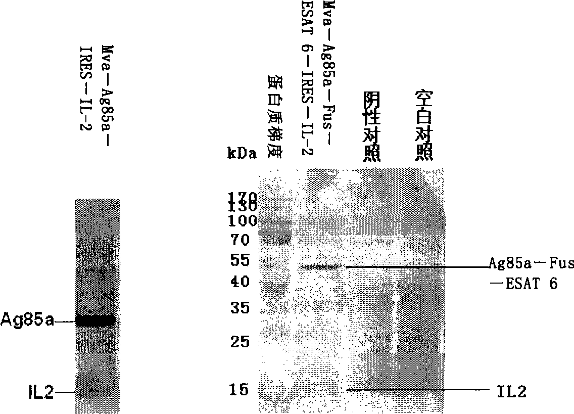 Preparation of novel tuberculosis vaccine and use thereof