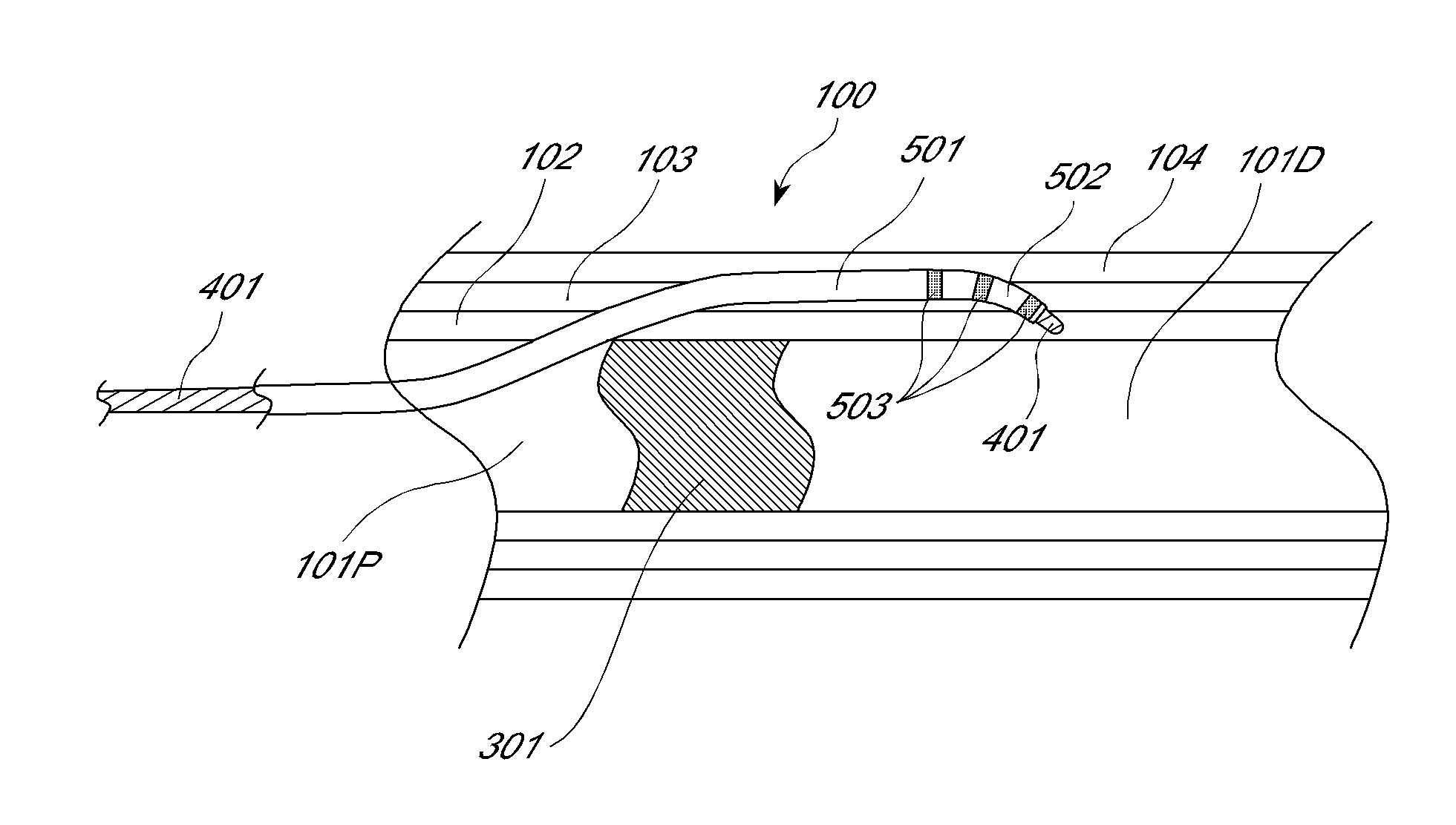 Device and method for vascular re-entry