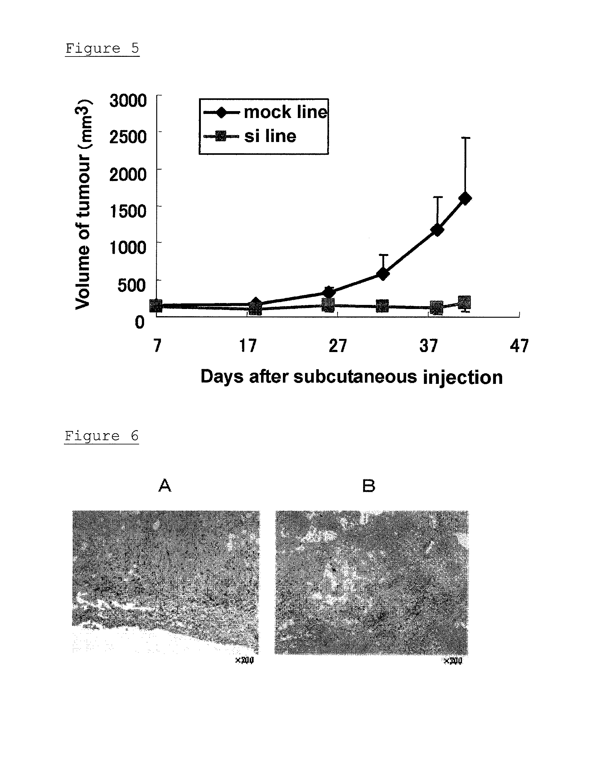 Pharmaceutical composition for treatment of cancer and asthma