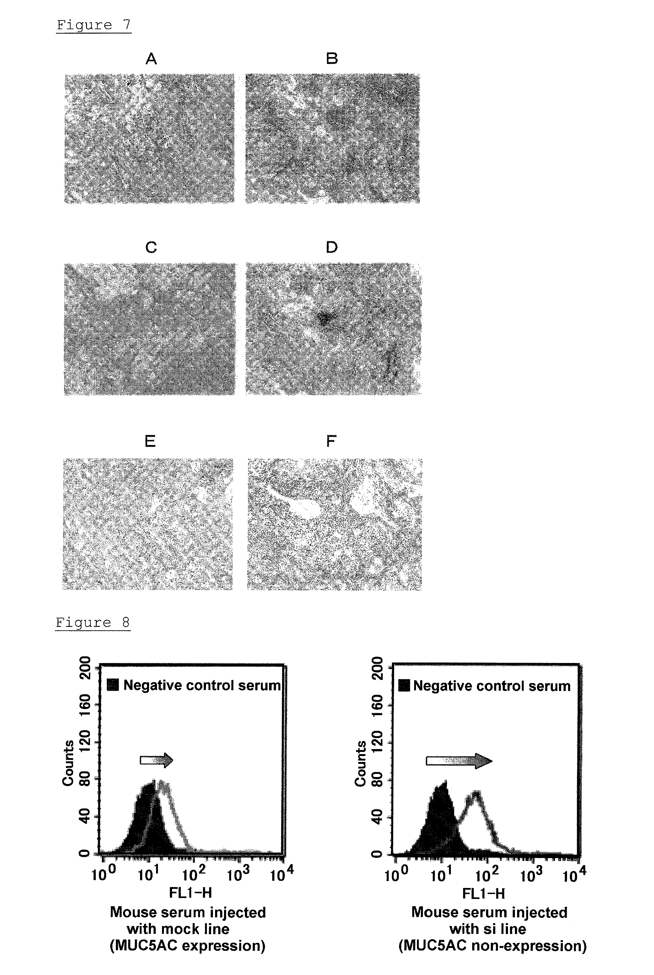 Pharmaceutical composition for treatment of cancer and asthma
