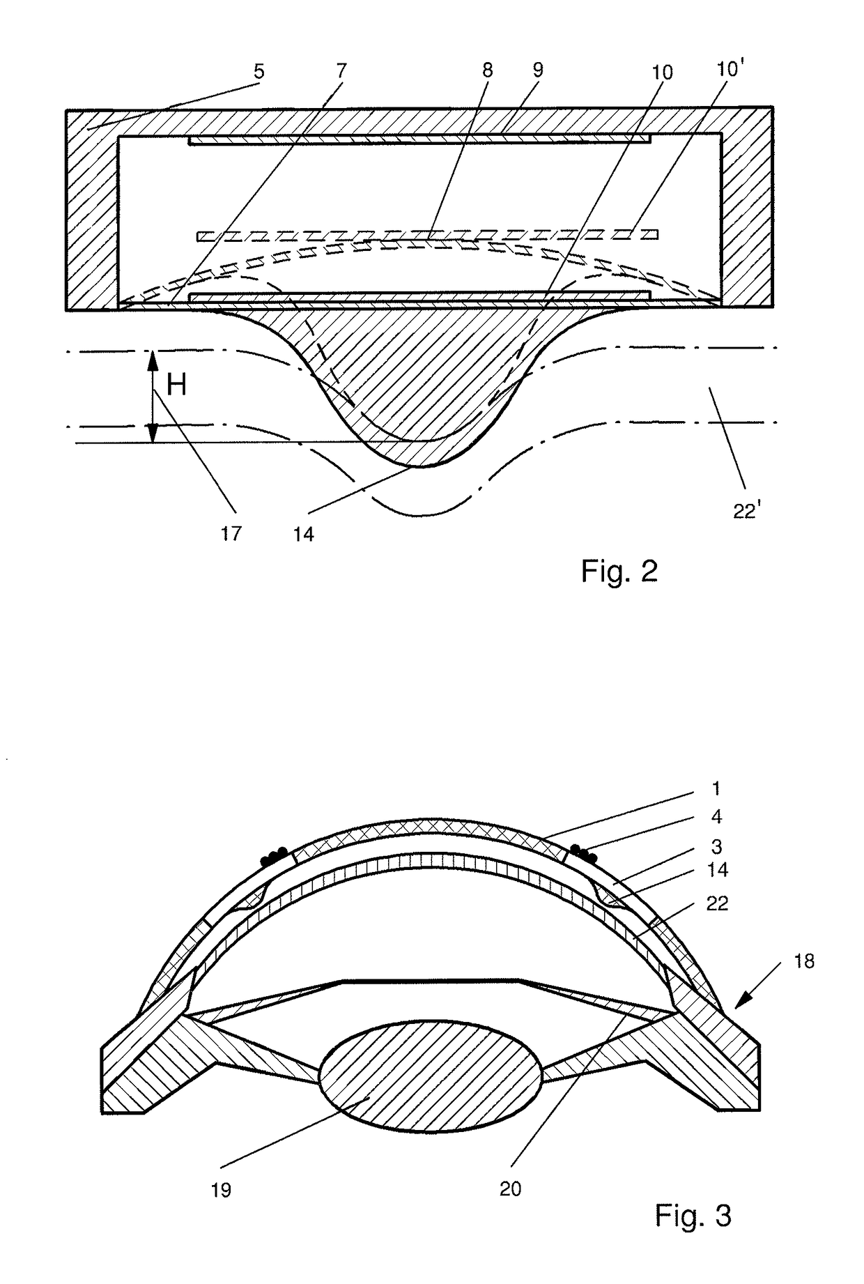 Method and device for monitoring biomechanical properties of the eye