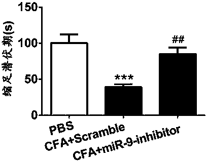 Application of mirna-9-5p compound in the preparation of chronic pain diagnostic markers and therapeutic drugs