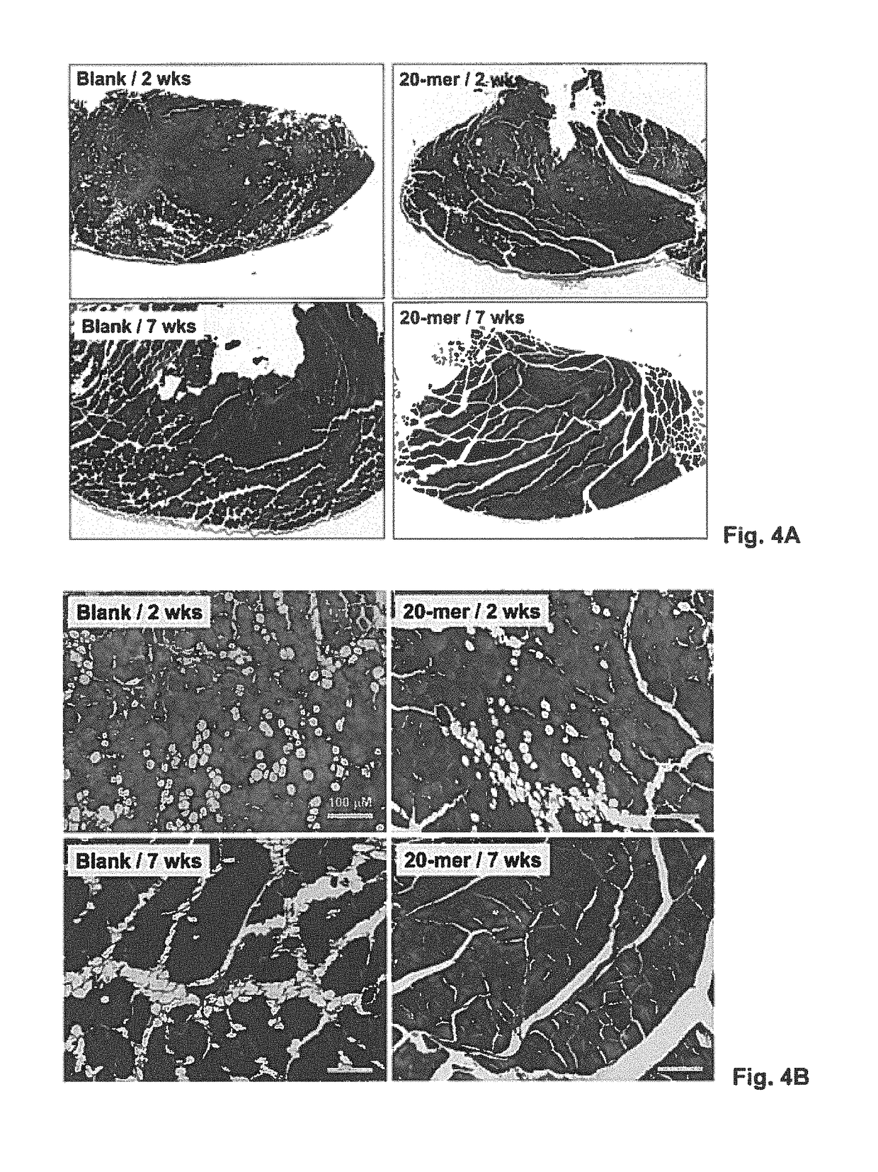 Use of PEDF-derived polypeptides for promoting muscle or tendon regeneration or arteriogenesis